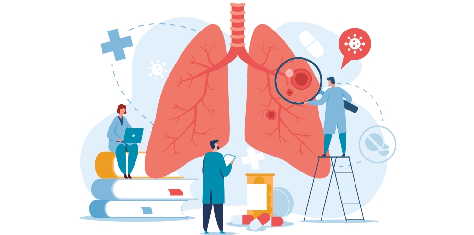 Lee más sobre el artículo Tratamiento de la exacerbación de la enfermedad pulmonar obstructiva crónica (EPOC)
